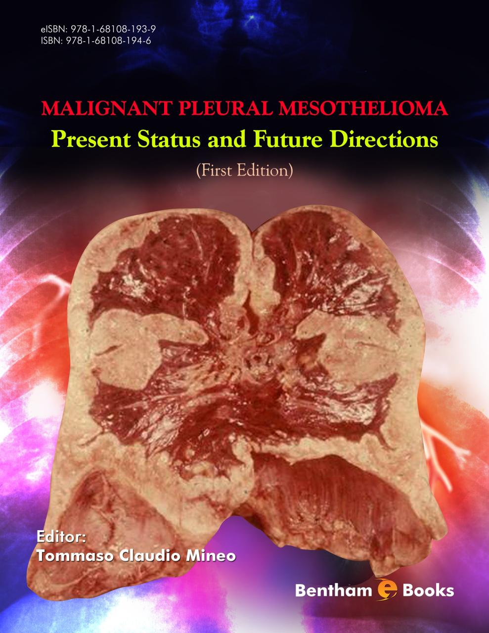 Mesothelioma Claims Process	Informational